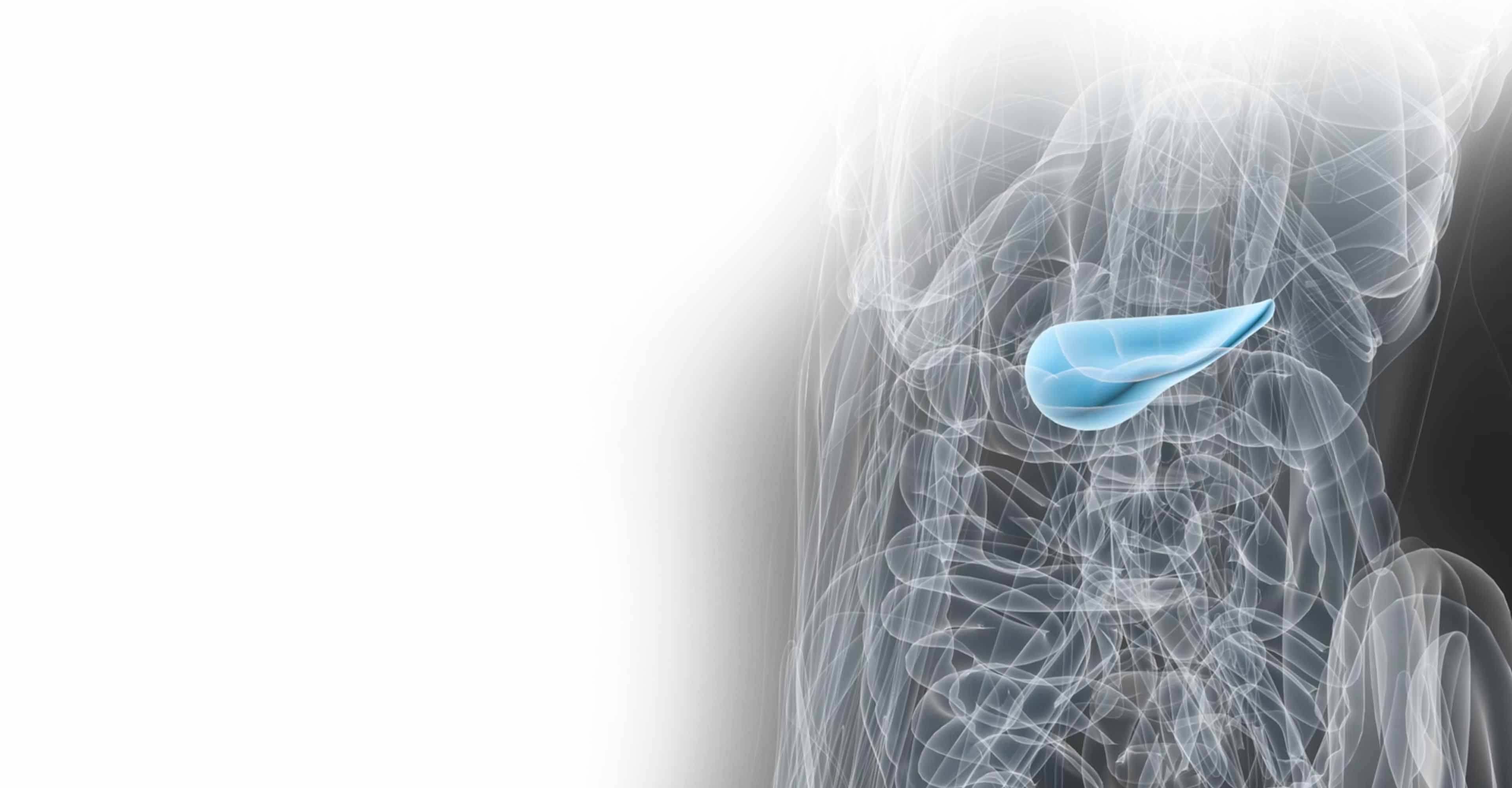 Radiotherapy for pancreatic cancer | Elekta