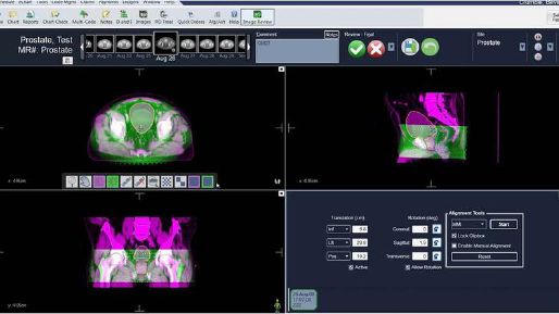 Screenshot of the MOSAIQ radiation prostate test screen