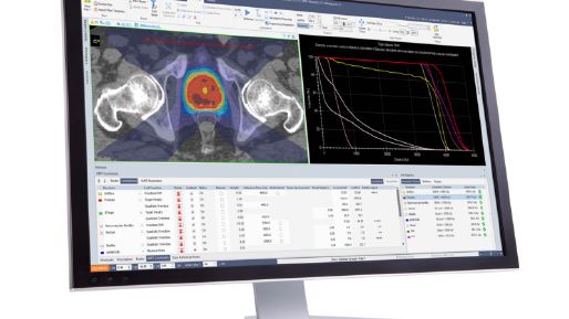 Angled monitor showing Monaco treatment plan in light mode