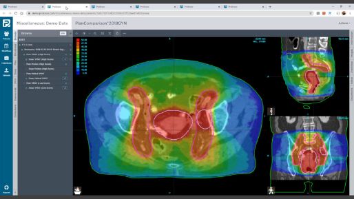 Screenshot of ProKnow CT scan page