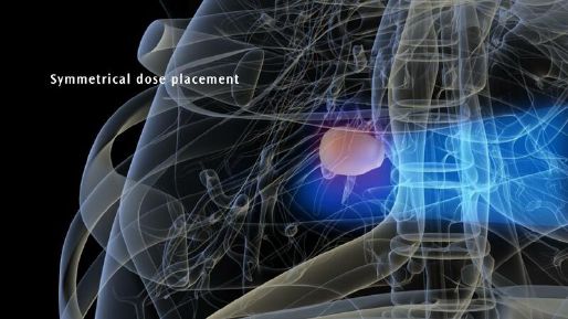 Symmetry - 4D Symmetrical Dose Placement