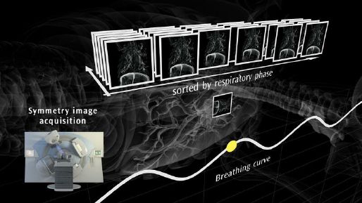 Symmetry Image Acquisition flow