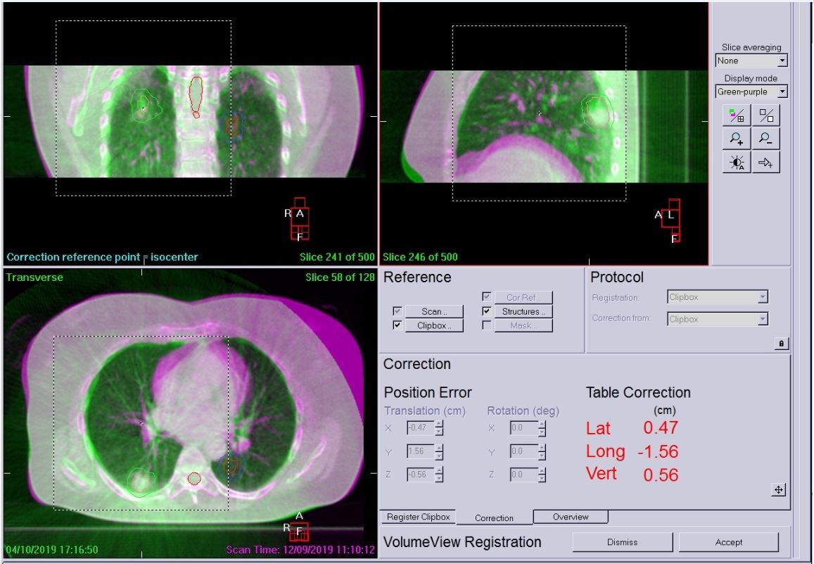 Figure 4 Right Side Lfov Scan