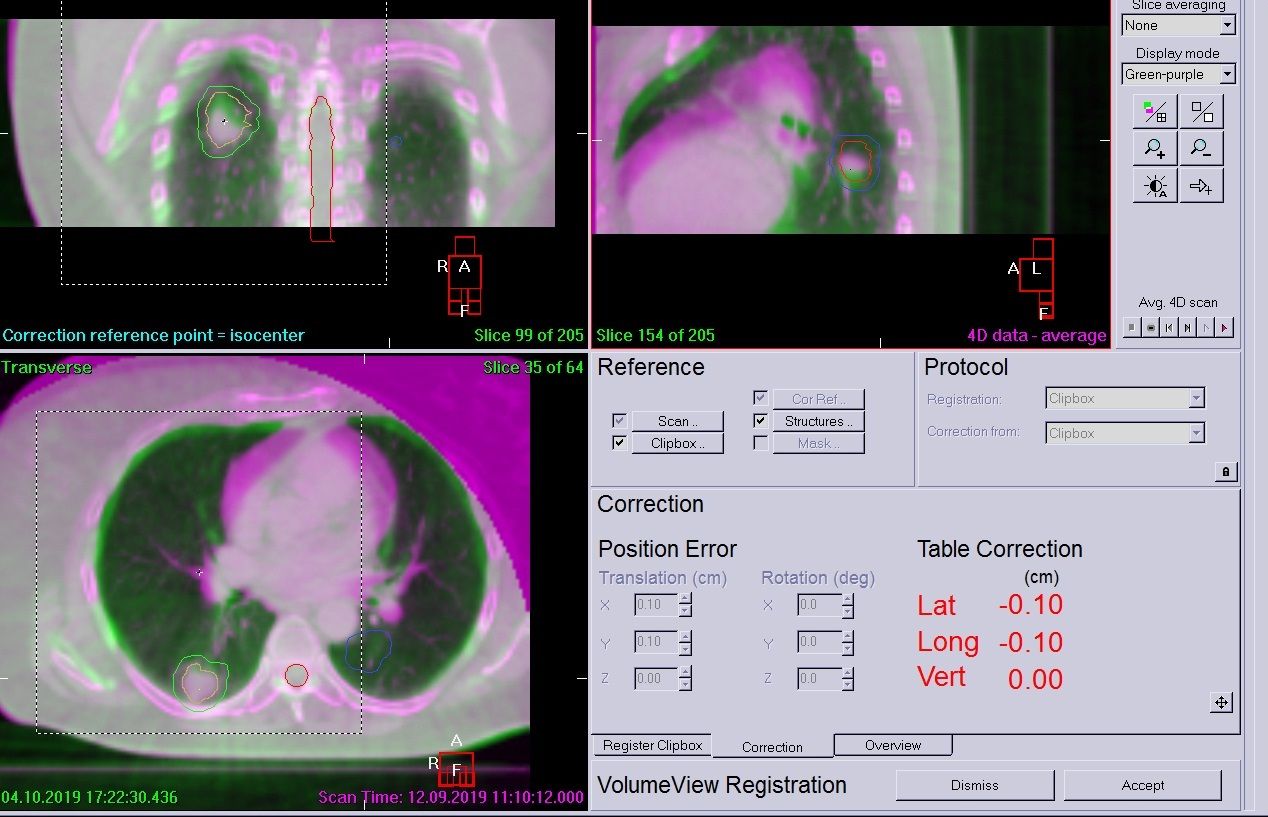 Figure 5 Right Side Mfov Scan