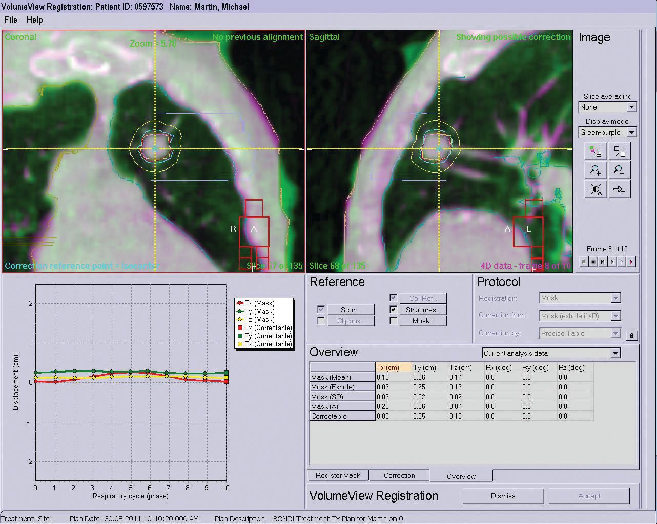 Figure12