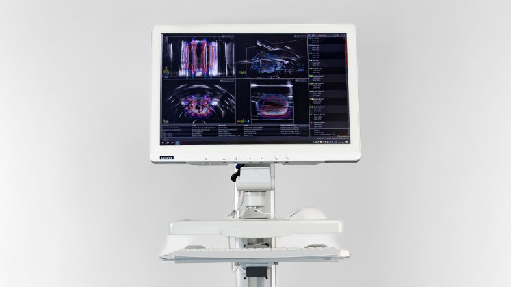 Prostate Guideway close-up