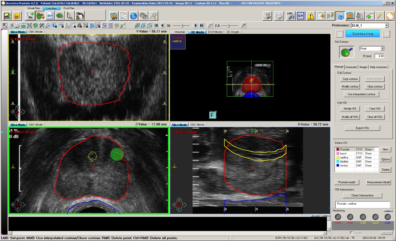 Oncentra software screenshot