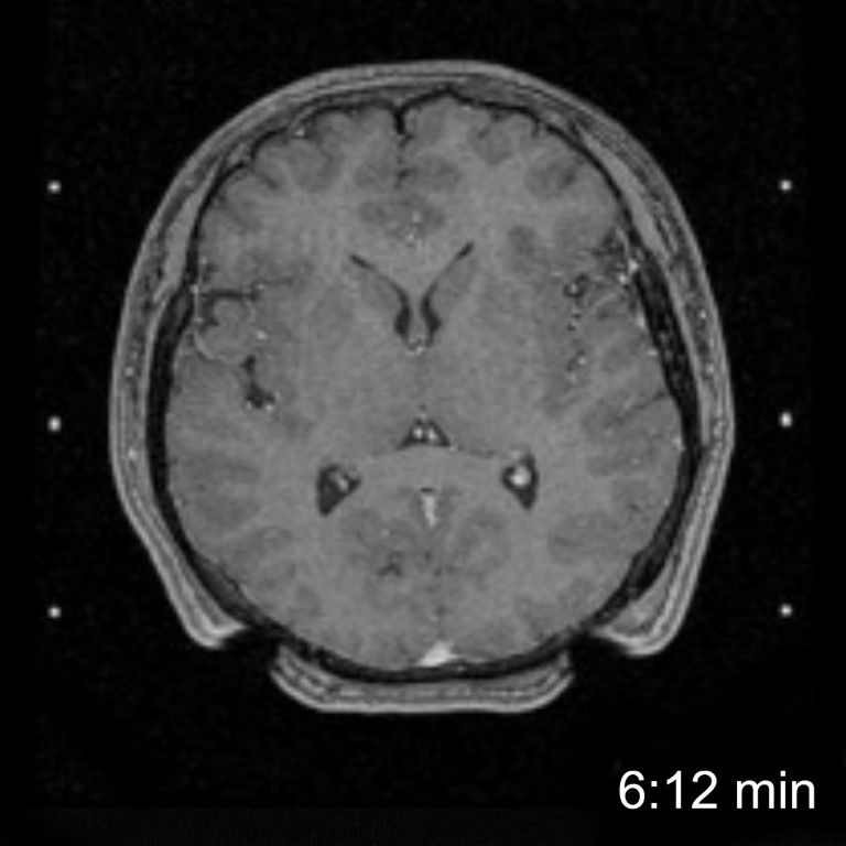 MRI Scan comparison - original