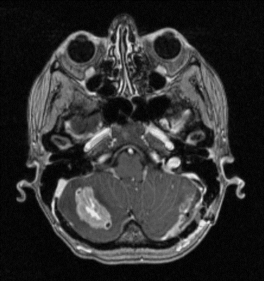 Mri scan of a brain